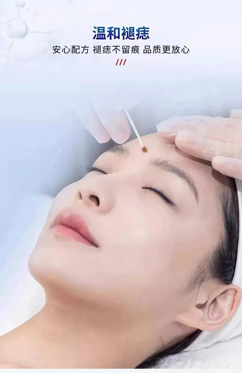 3瓶元只要29.9!针对黑痣,肉痣,凸痣,疣瘊