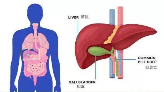 胆结石在身体的位置图图片