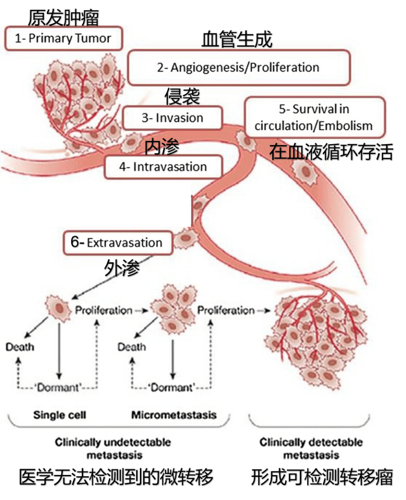 90%癌症相关死亡都是由转移引起!癌症转移是怎么回事?