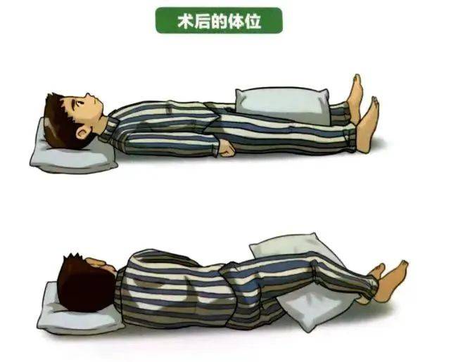 髋关节置换术后"居家康复那些事"