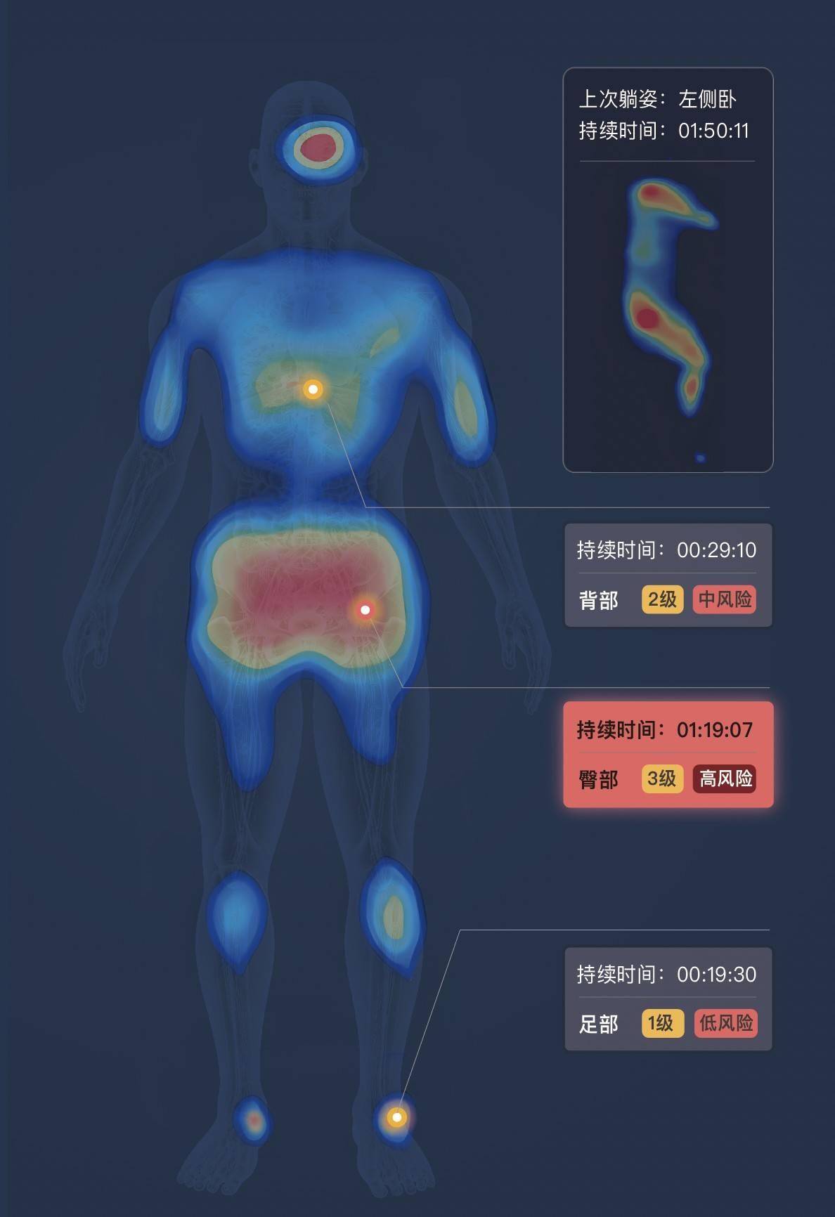 柔性纤维传感器推进至量产，「矩侨工业」获近千万元天使轮融资