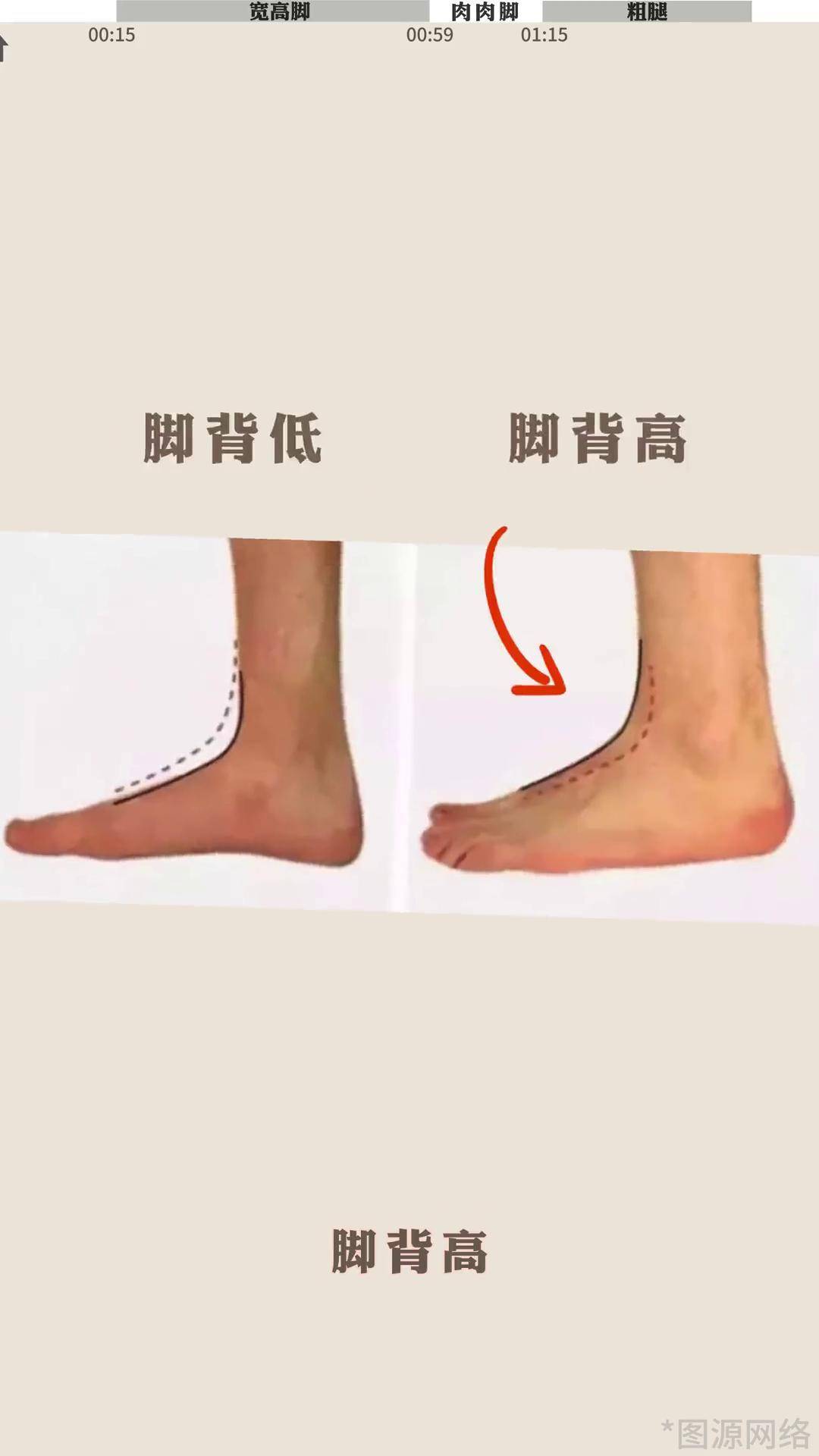 脚背高,宽脚,肉脚,小腿粗的姐妹,你知道怎么穿凉鞋,才能显瘦显高吗?
