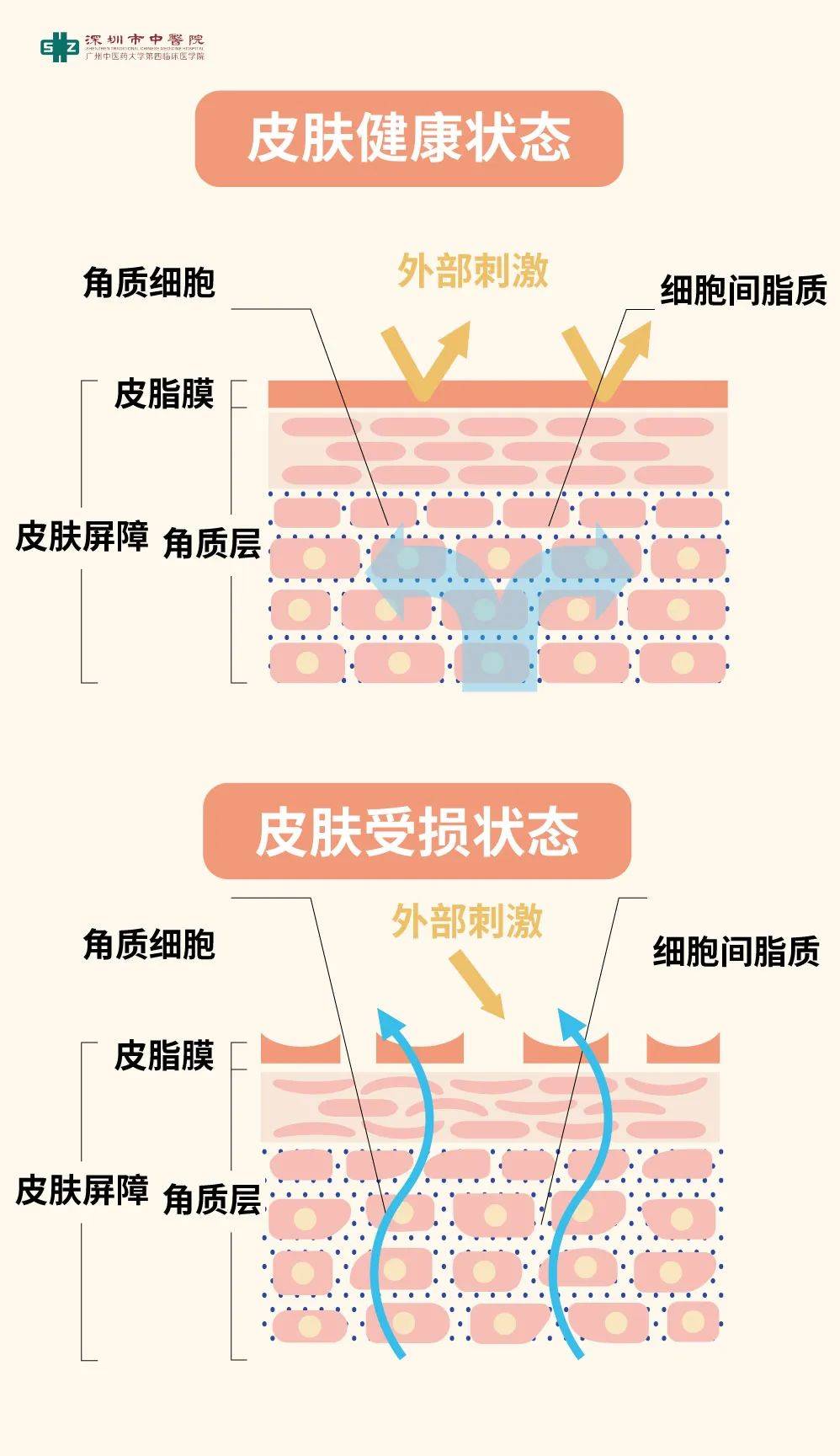 皮肤屏障受损的症状图片