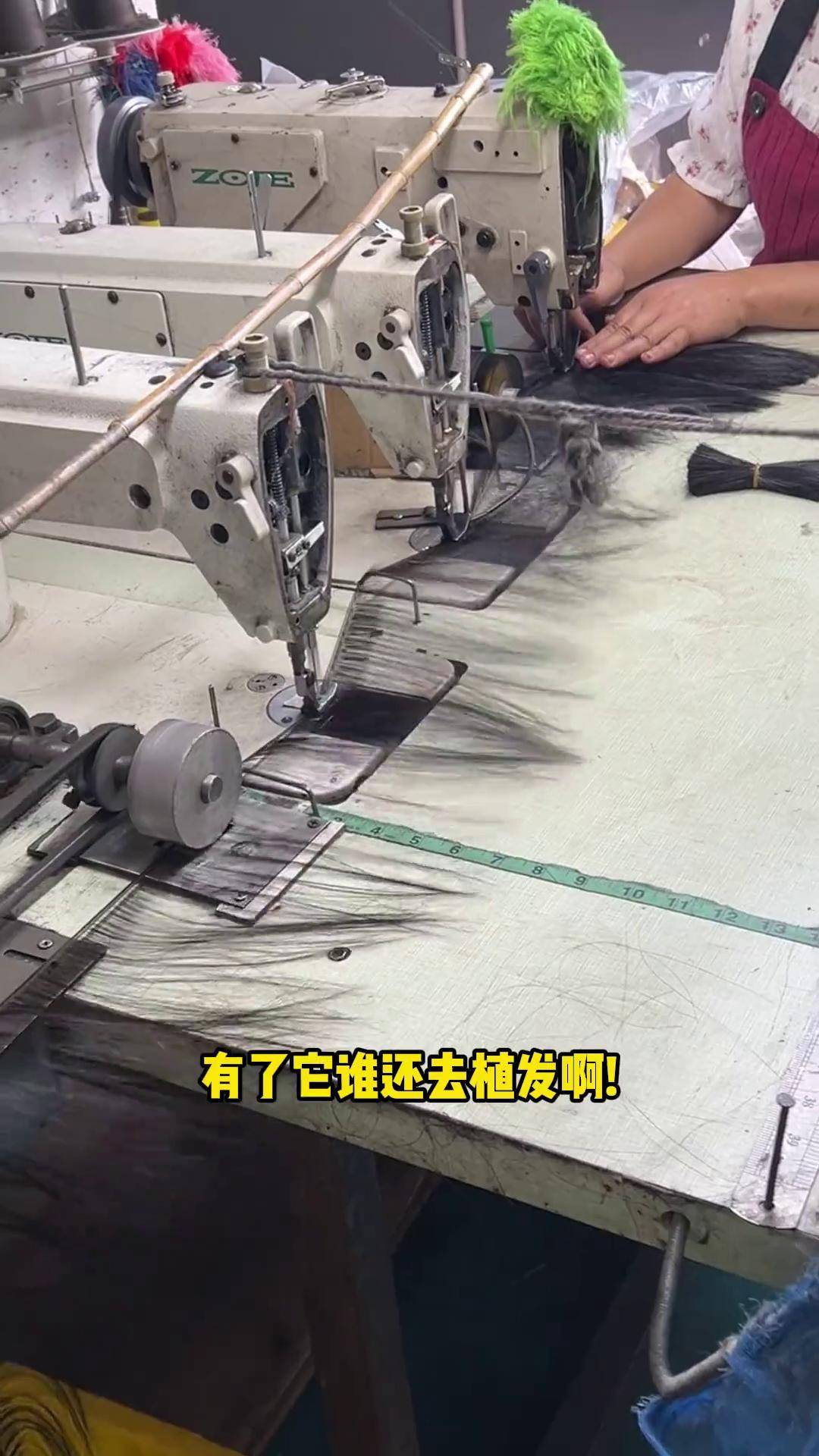 除了假发和植发(头发除了植发还有别的办法吗)