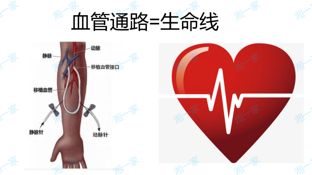 【ppt】血管通路的建立和维护——医生的角度谈护理