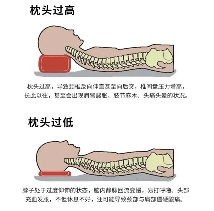 颈椎枕头正确枕法图片