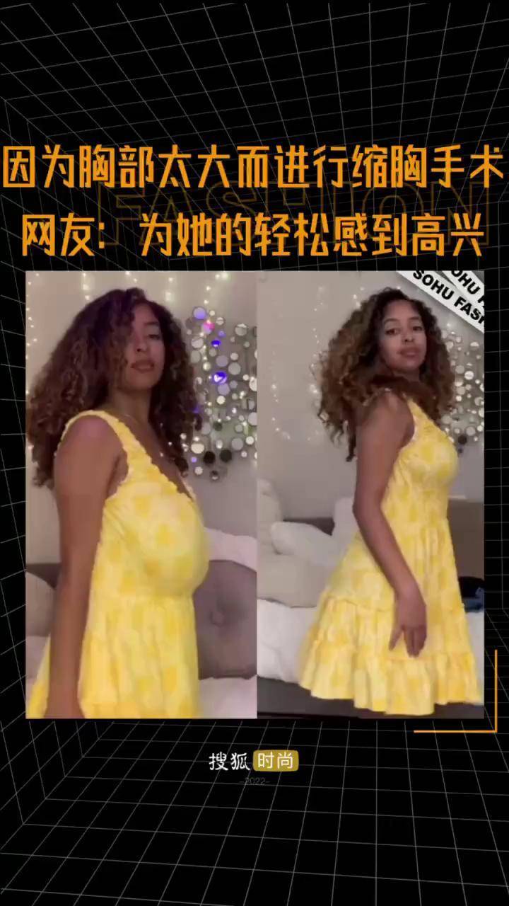 因为胸部太大而进行缩胸手术 网友:为她的轻松感到高兴