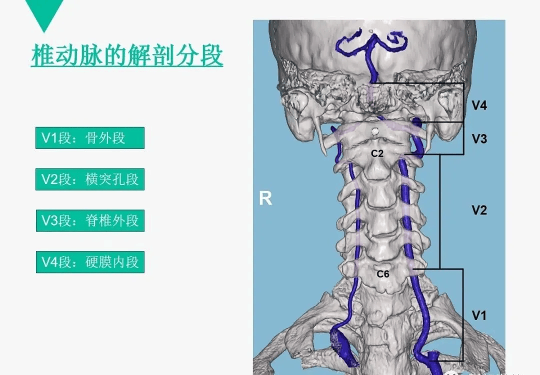 头颈部CTA解剖图片