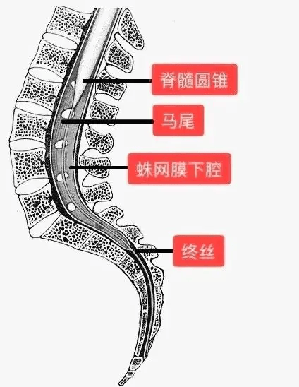 脊髓圆锥位置低