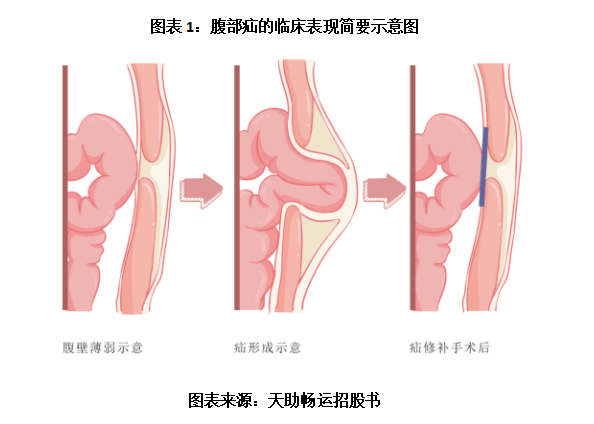 天助畅运IPO中止：国产第一，年收入仅2.2亿元，深交所三问业绩成长性