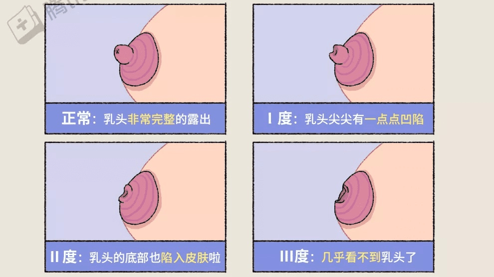 什么是胸 摸着图片