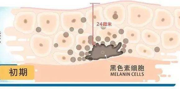 斑分为哪几种？不同的斑如何调理？