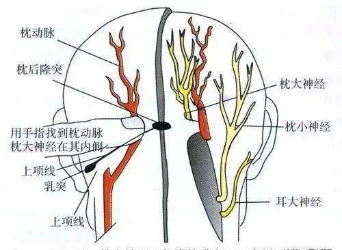 偏头痛之枕大神经卡压