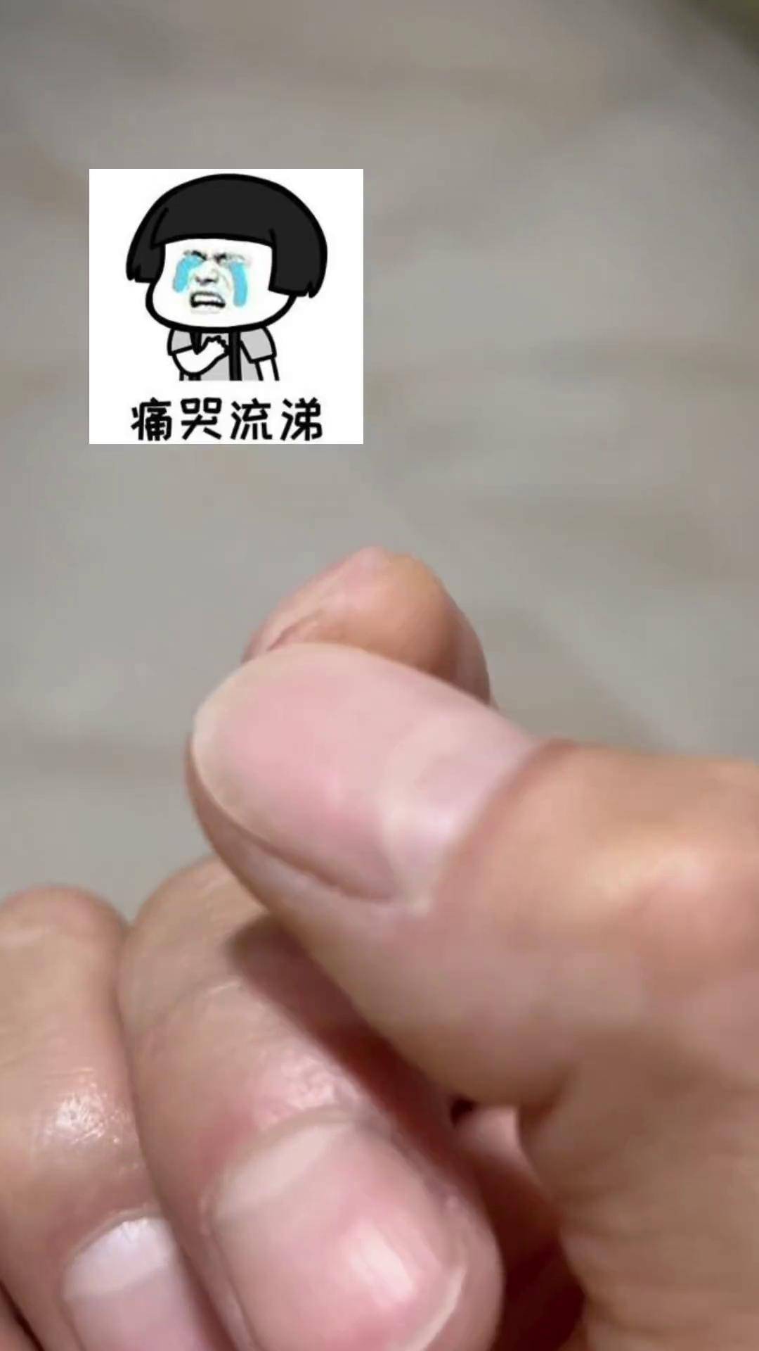 玩胶带球手烂图片