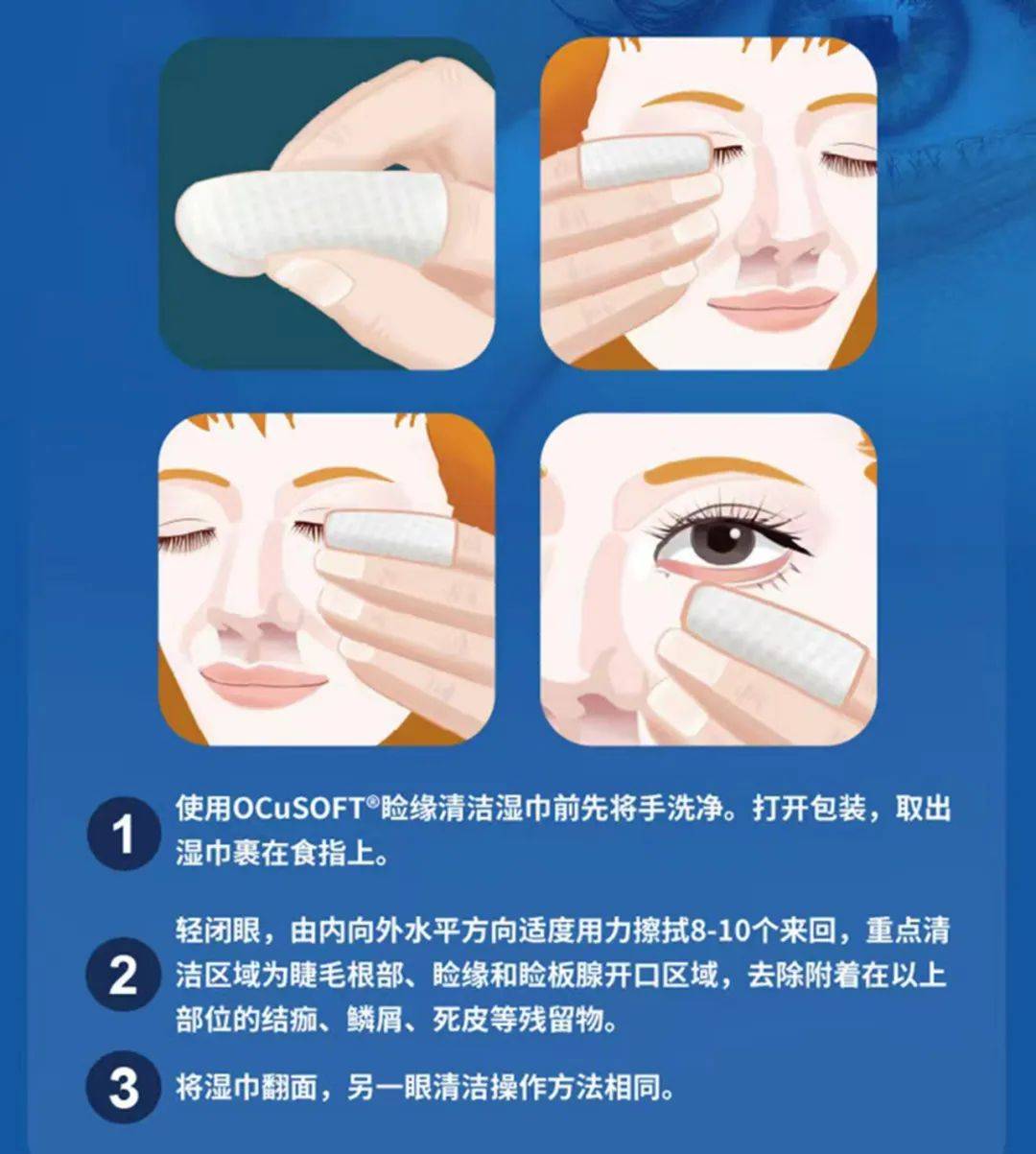 睑板腺按摩通过机械挤压睑板腺,疏通堵塞的睑板腺