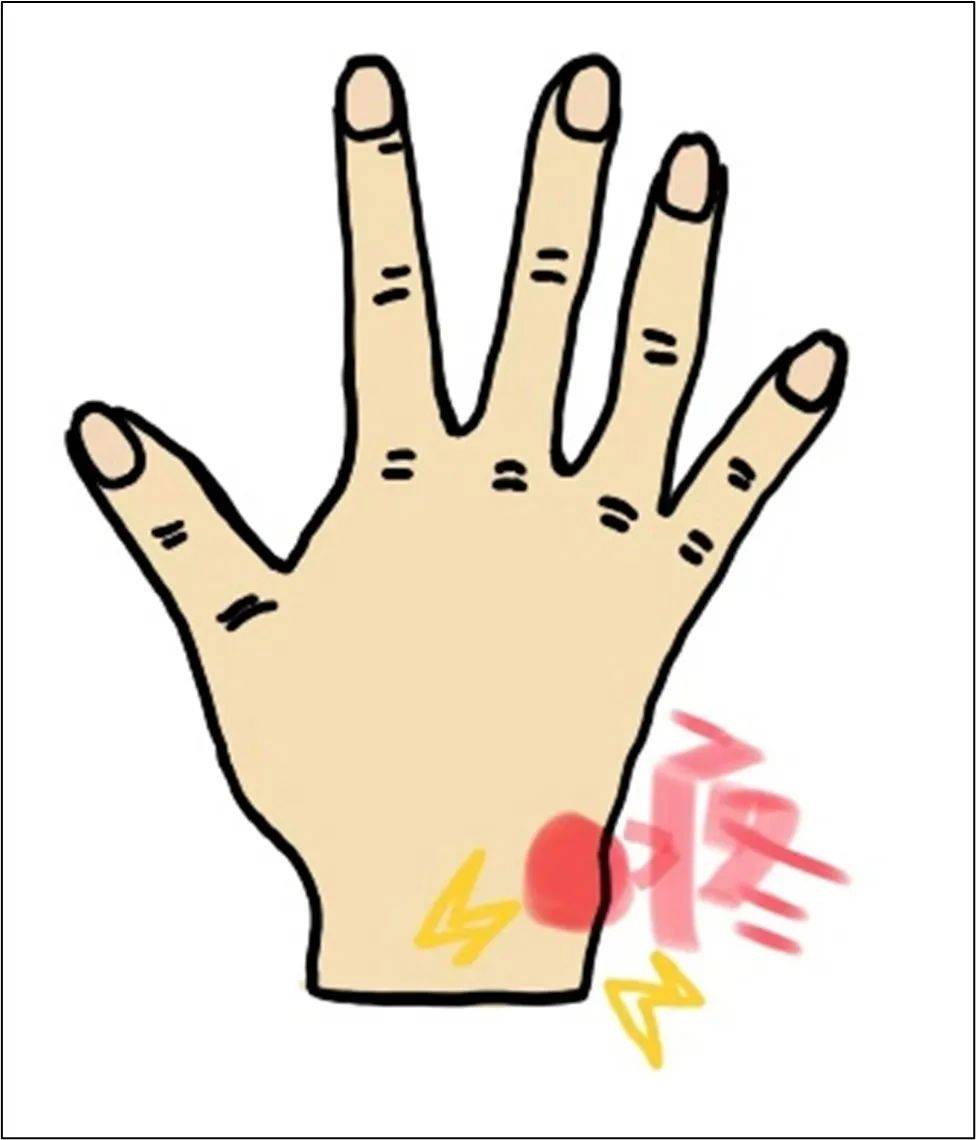 手腕_治疗师_康复