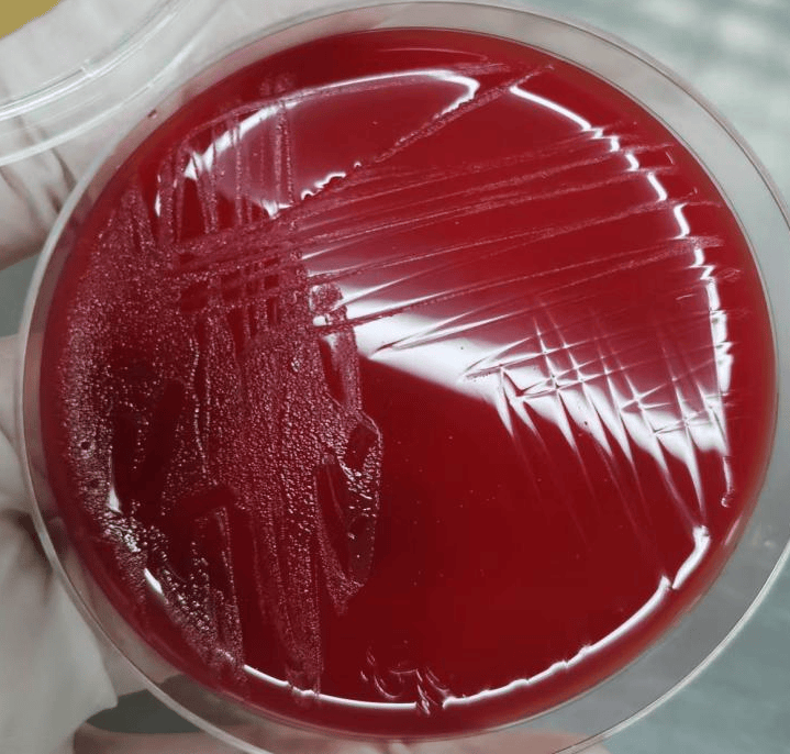 一布鲁氏菌感染病例分享及实验室诊断