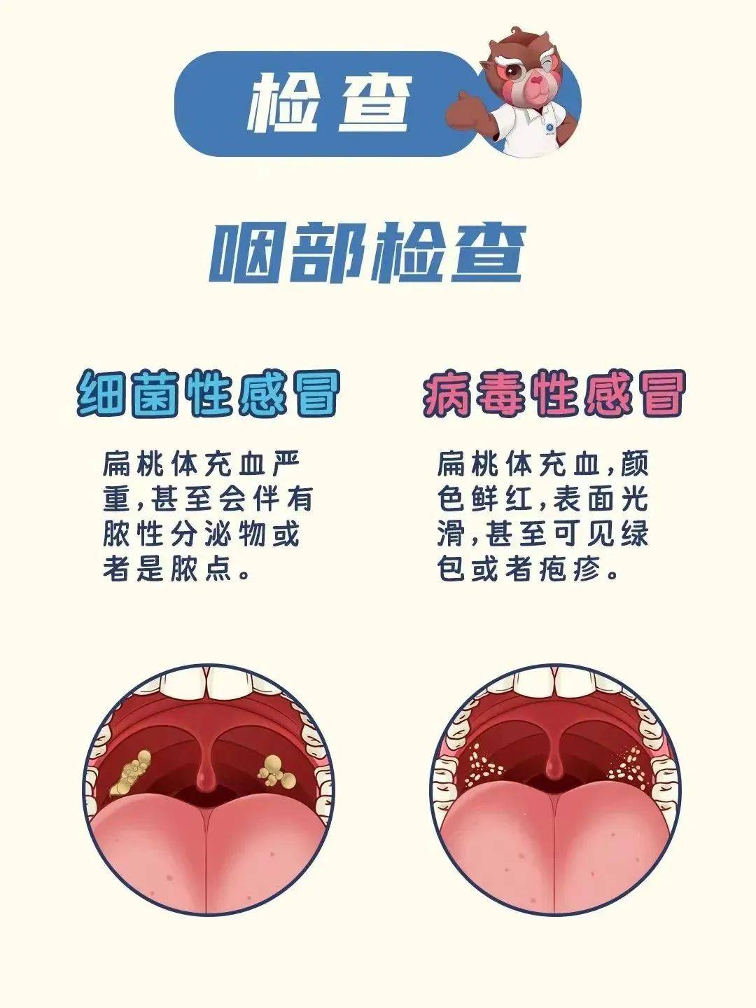  喉咙痛怎么区分病毒和细菌感染(喉咙痛怎么区分病毒和细菌感染呢)