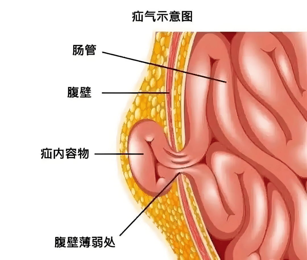 科普地址:门诊楼三楼317室外一科时间:3月7日活动时间及地址参与方式4