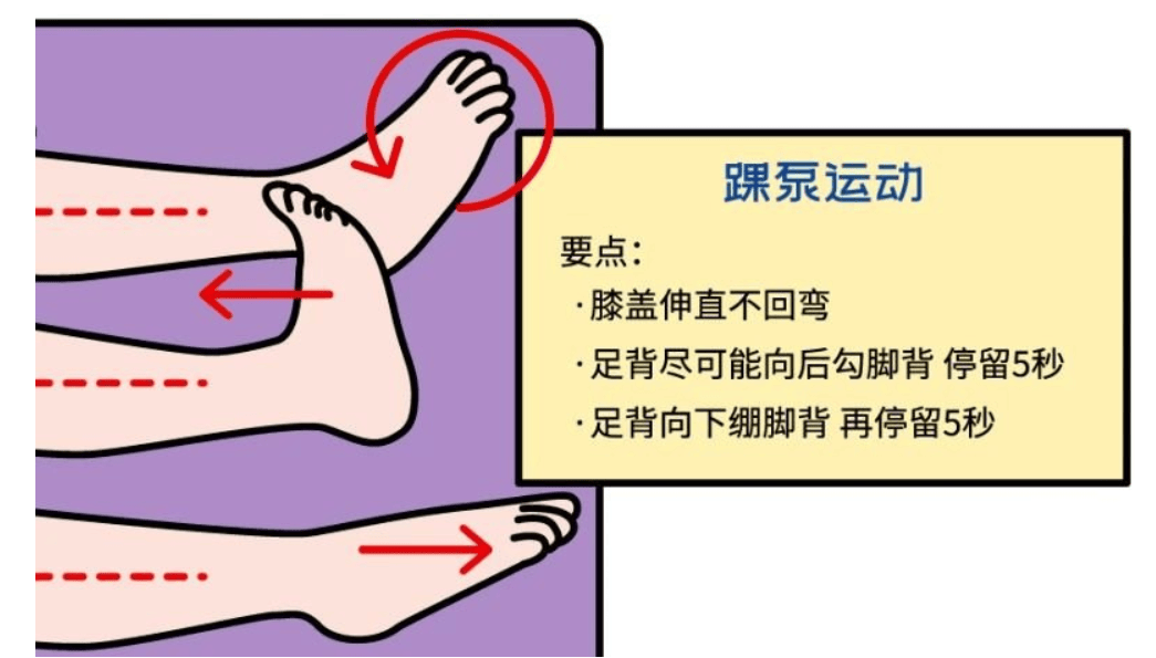 踝泵运动,不花一分钱,给您的血管做"按摩"