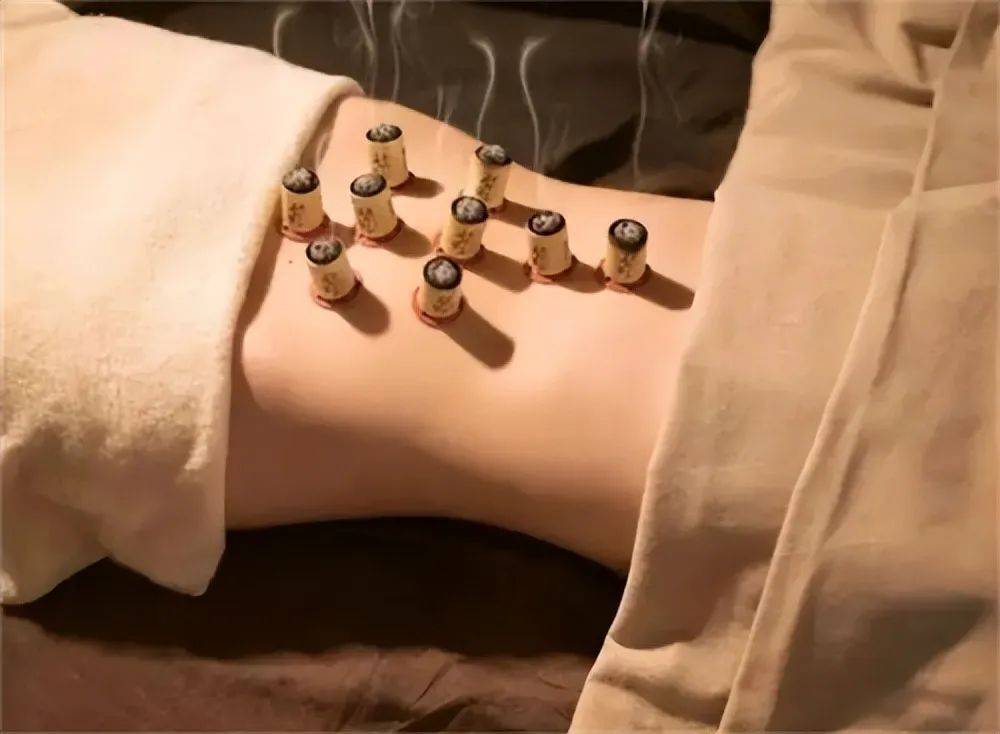 苏州女子长期坚持艾灸,可没想到医生的话让她傻眼了!