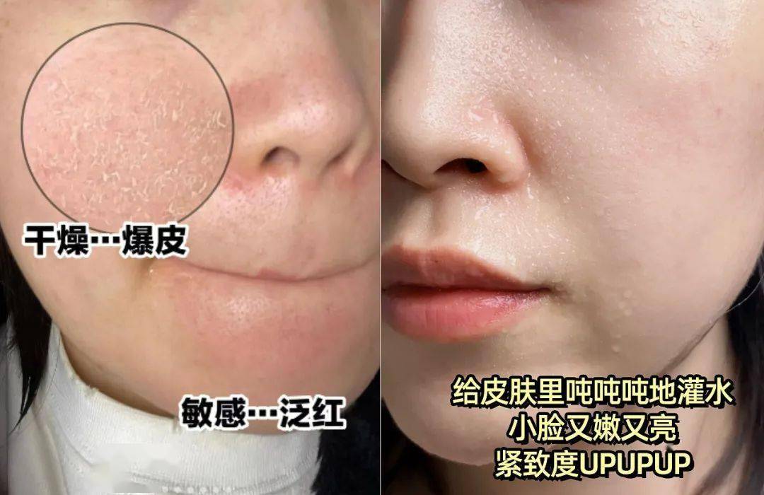 FPN保加利亚玫瑰纯露，补水焕亮一步到位！ 姐妹们必看！FPN保加利亚玫瑰纯露，让肌肤喝饱水！