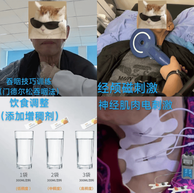 这项"黑科技"能治疗吞咽障碍