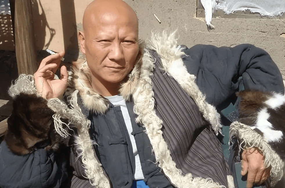 在拍《新少林五祖》时为了演出马宁儿中毒浑身流脓的视觉效果计春华