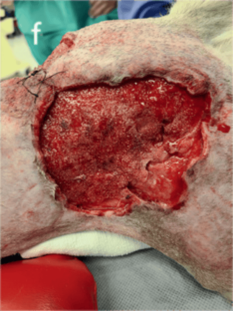 外科医生必学!最新资料总结动物创伤的6种清创操作