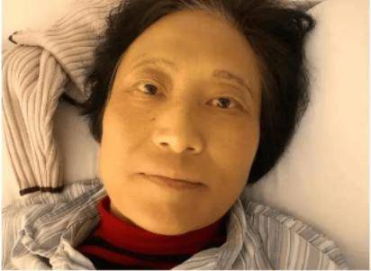 这位59岁的姐姐被诊断出患有胰腺癌。他通常喜欢喝水而不喝酒。医生点了点头