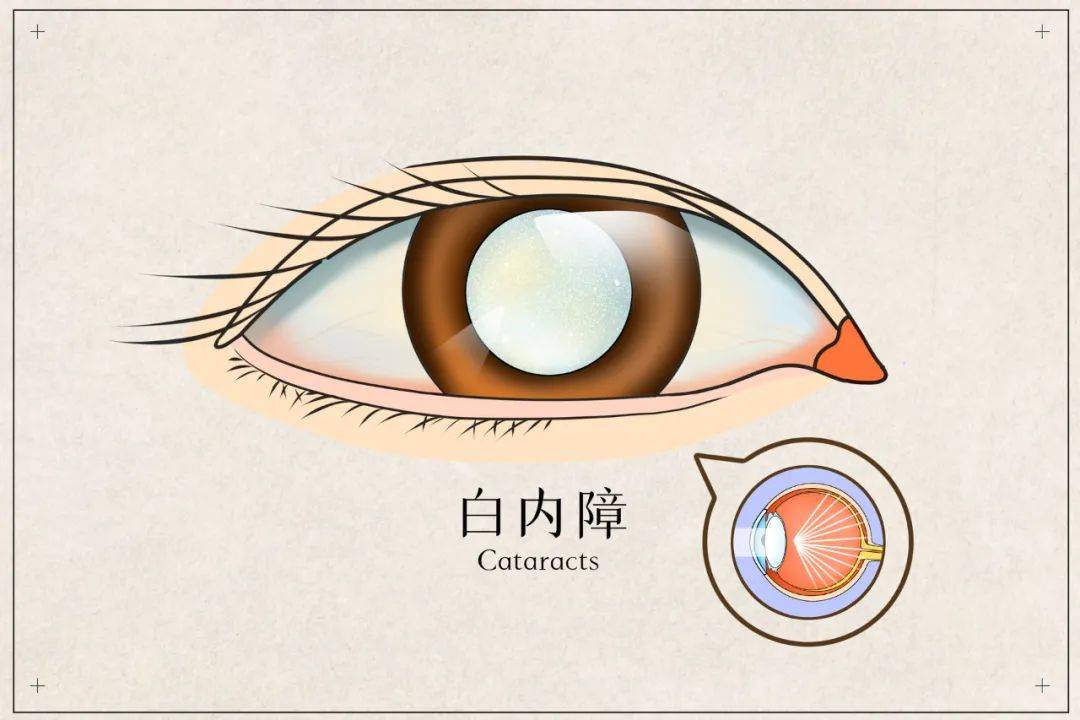 您看到模糊的东西并失去了视线吗？照顾这种疾