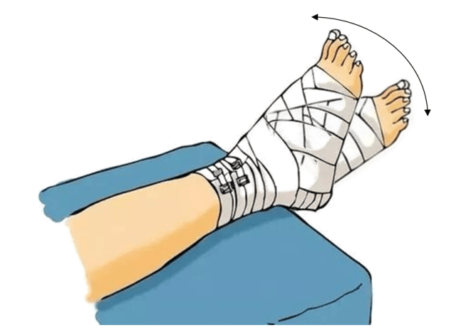 认识跟骨骨折 保护我们的"承重基石"