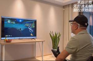 用意念玩游戏！我国成功开展首例侵入式脑机接口临床试验