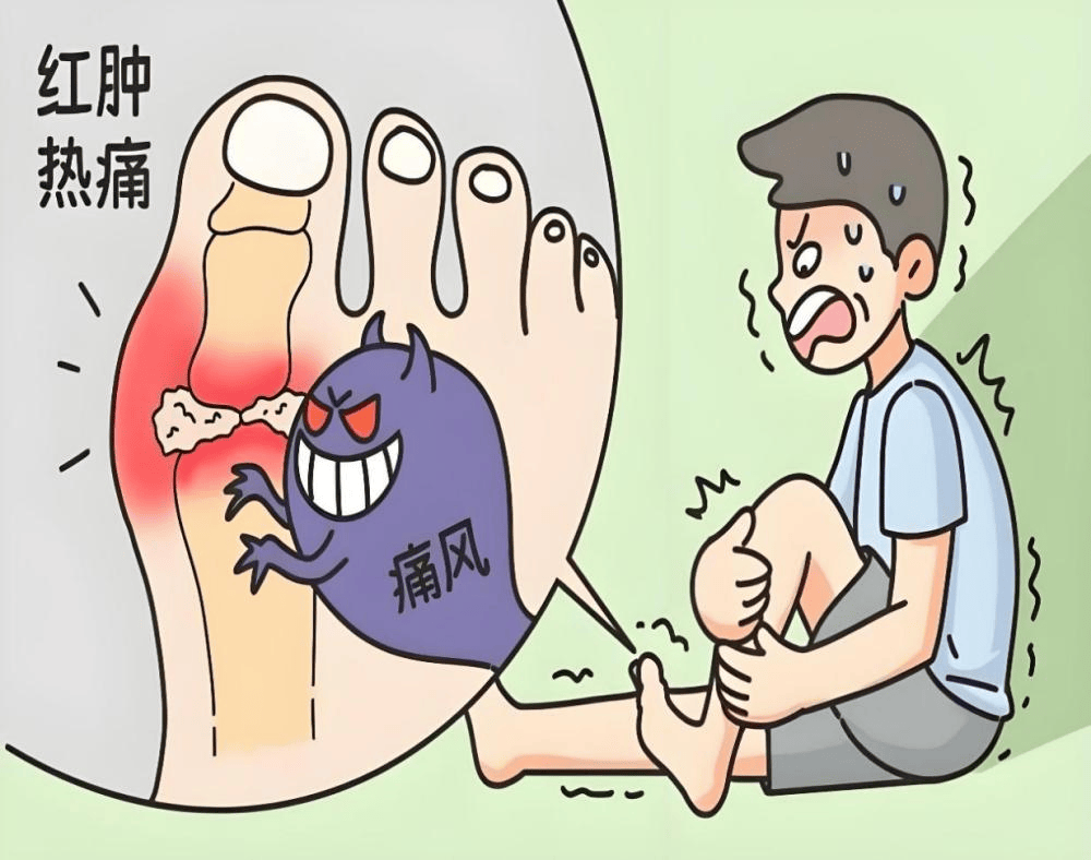 冰啤酒一时爽,小心痛风"秋后算账"