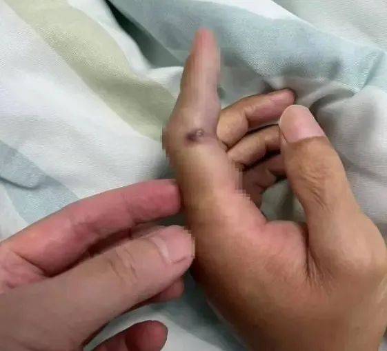 【消费提示】“开渔季”到了！这份健康尝“鲜”指南快收藏！