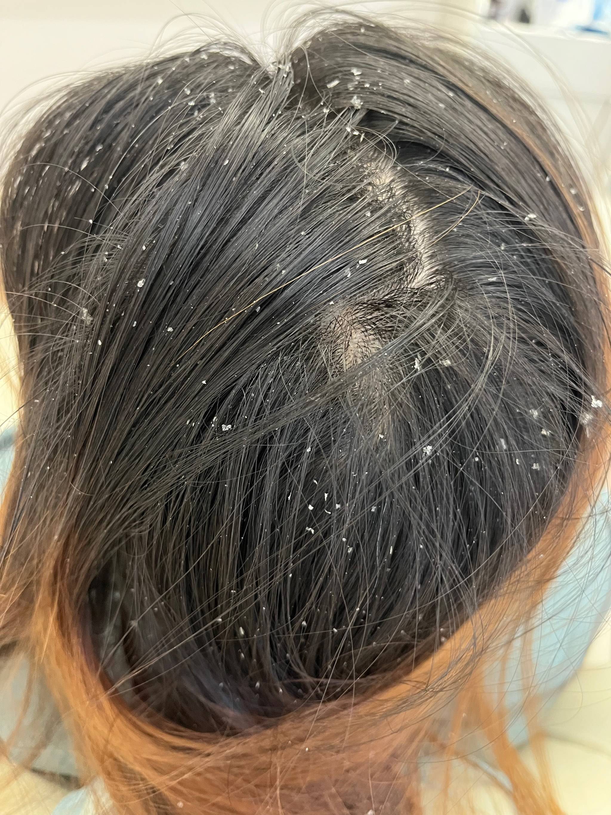 什么牌子洗发水去屑止痒控油?头发塌蓬松洗发水攻略