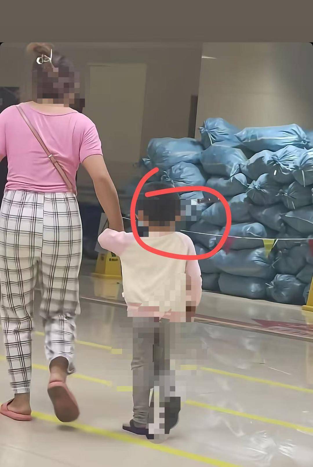 云南“头上插刀”女童淡定走进医院后续：已手术成功取刀 女童身体情况稳定