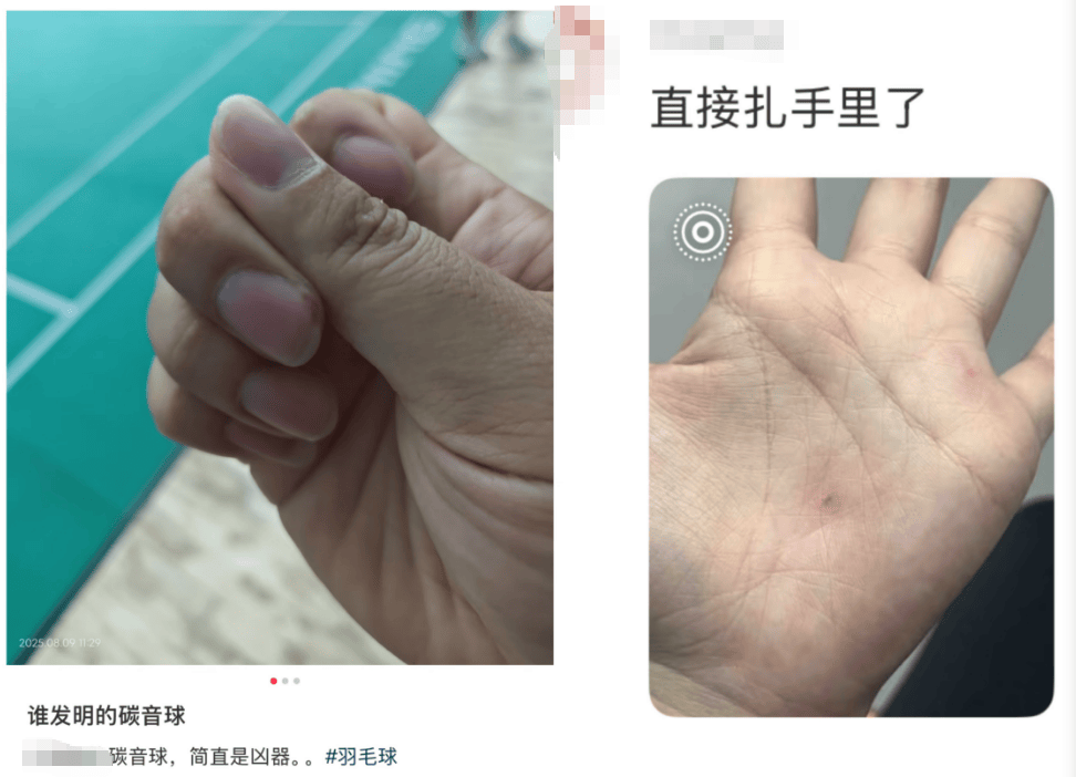 击穿眉骨、扎穿手指…这项人气运动暗藏风险！