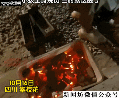 四川攀枝花一男童掉进烧烤店炭堆，全身烧伤！网友：光看就疼得不行