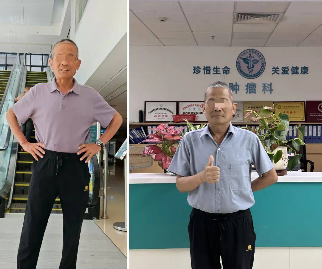 绝境重生!吴川市人民医院肿瘤科为晚期癌症患者点亮生命之光