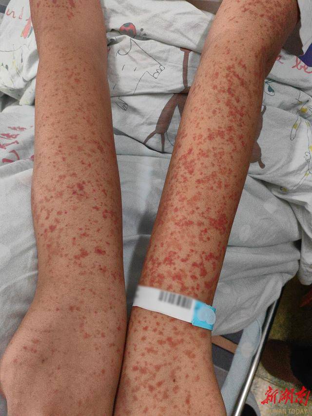  近期高发的儿童疾病(儿童高发重大疾病排名)