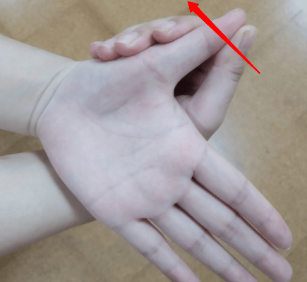 产妇手腕疼是月子病吗?怎么缓解?