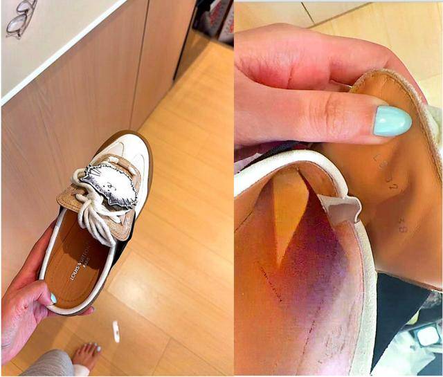 女子购万元LV运动鞋双脚多处破皮要求退款被拒 客服:只能换(图3)