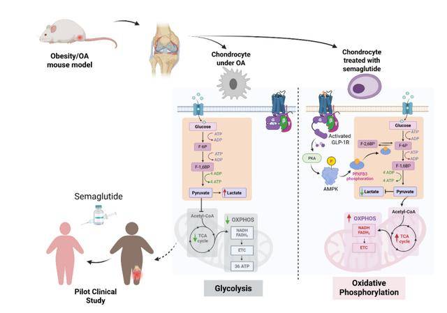 “减肥神药”也能治疗骨关节炎？科学家揭示其关键机制