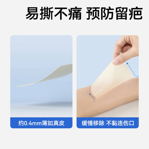 无菌敷贴怎么用稳健无菌敷贴使用体验：比传统创口贴更安全有效！_https://www.jmylbn.com_新闻资讯_第2张