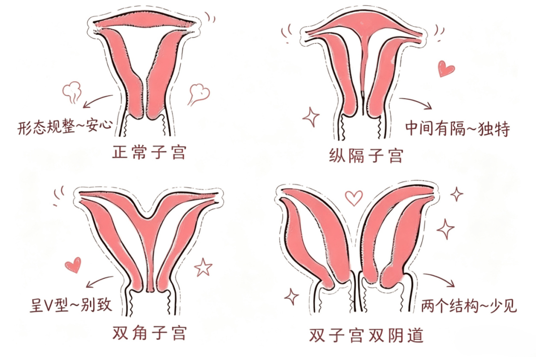两个子宫，还能顺利当妈妈吗？ | 宫守有道，拆违拓建