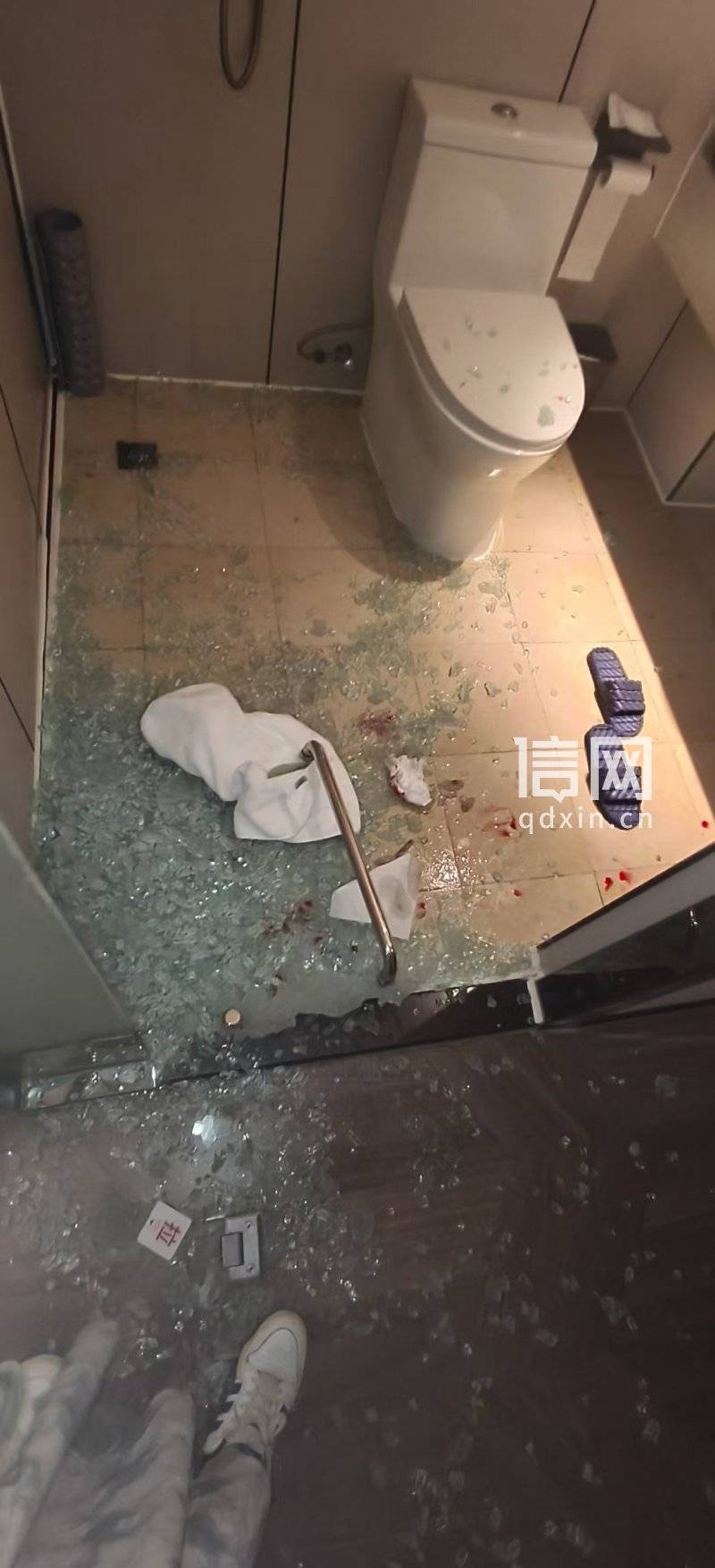 西安汀泊酒店卫生间玻璃门突然炸了 16岁