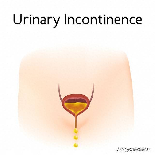 男人过了四十尿频尿急、夜尿多，别急着补肾，这七味平价药才对症