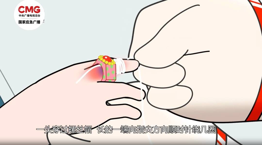 厨房里的这个小洞,千万别用手指去试探!已有人“中招” (pic6) 厨房里的这个小洞,千万别用手指去试探!已有人“中招” (pic6)